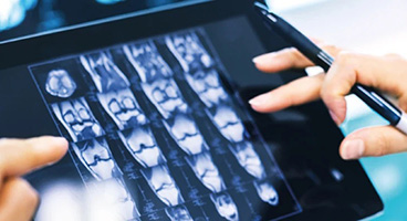 Hands tap on a tablet on which X-ray images can be seen